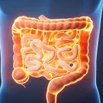 Saiba os sintomas do câncer colorretal, segundo coloproctologista