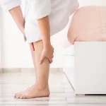 Varizes: saiba as principais causas e quando procurar um especialista