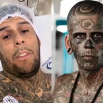 “Mais tatuado do Brasil”, influenciador revela câncer maligno após cirurgia